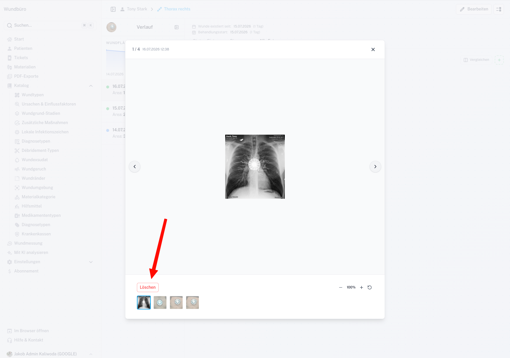 Wound Behandlung Modal Screenshot