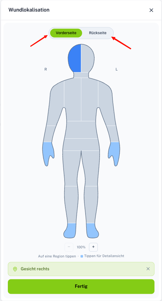 Wound Status Modal Screenshot